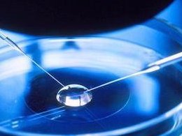 HIV是什么意思，到底该怎么治疗？