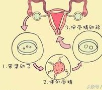 国内三代试管婴儿费用是多少？三代试管价格多少？