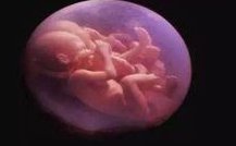 人工授精失败能做试管婴儿吗？