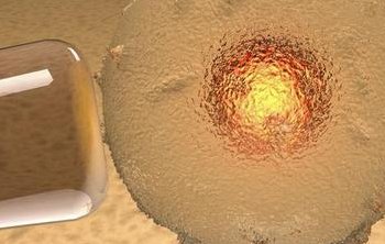 成功率多少？nic可做第三代试管婴儿吗？泰国nic做试管找玛祖？